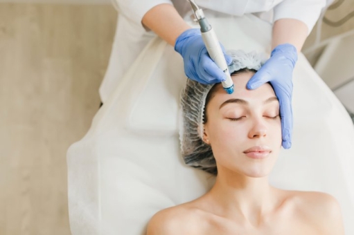 What is facial photorejuvenation and why is it in fashion?
